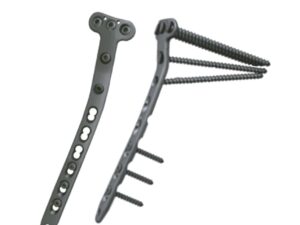 Placa LOC de tibia proximal medial AV 3.5mm